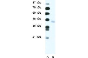 Human Jurkat; WB Suggested Anti-ZNF312 Antibody Titration: 2. (FEZF2 anticorps  (N-Term))