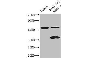 Western Blot Positive WB detected in: Mouse heart tissue, Mouse skeletal muscle tissue All lanes: IQCG antibody at 3. (IQCG anticorps  (AA 1-134))