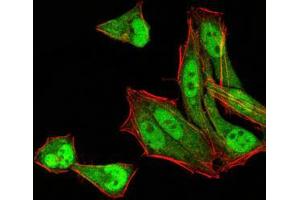 Immunofluorescence analysis of Hela cells using MGMT mouse mAb (green). (MGMT anticorps  (AA 32-210))