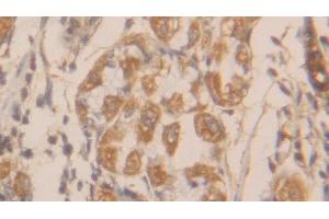 Detection of CLC in Human Stomach Tissue using Polyclonal Antibody to Charcot Leyden Crystal Protein (CLC)