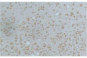 Immunohistochemistry of paraffin-embedded Rat brain tissue using Phospho-CAMK2 beta/gamma/delta (Thr287) Monoclonal Antibody at dilution of 1:200. (CaMK2 beta/gamma/delta (pThr287) anticorps)