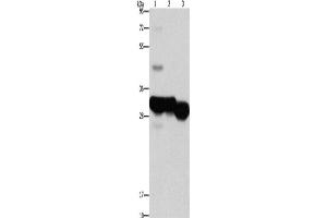Western Blotting (WB) image for anti-Ketohexokinase (KHK) antibody (ABIN2422886) (Ketohexokinase anticorps)