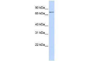 WB Suggested Anti-NCAPH2 Antibody Titration: 0. (NCAPH2 anticorps  (N-Term))