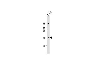 Anti-LSM7 Antibody (C-term) at 1:1000 dilution + Hela whole cell lysate Lysates/proteins at 20 μg per lane. (LSM7 anticorps  (C-Term))