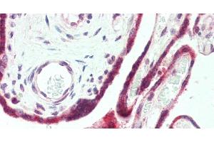 Immunohistochemistry of paraffin-embedded Human Placenta using PAPPA Polyclonal Antibody at dilution of 1:100. (PAPPA anticorps)