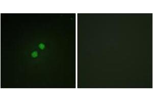 Immunofluorescence analysis of NIH-3T3 cells, using Nibrin (Phospho-Ser278) Antibody. (Nibrin anticorps  (pSer278))