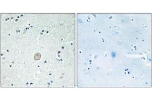 Immunohistochemistry analysis of paraffin-embedded human brain tissue, using C3AR1 Antibody. (C3AR1 anticorps  (AA 175-224))