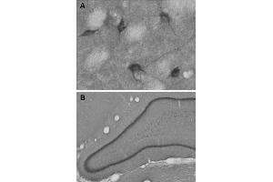 A: Indirect immunohystochemistry of a mouse striatum section (dilution 1 : 100).