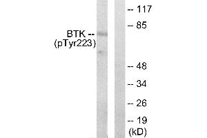 Western blot analysis of extracts from Hela cells treated with serum (10%, 15mins), using BTK (phospho-Tyr223) antibody. (BTK anticorps  (pTyr223))