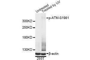 Western blot analysis of extracts of 293T cells, using Phospho-ATM-S1981 antibody (ABIN5969871) at 1/2000 dilution. (ATM anticorps  (pSer1981))