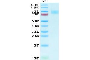 Human Siglec-4a/MAG on Tris-Bis PAGE under reduced condition. (MAG Protein (AA 20-516) (His tag))
