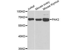 Western blot analysis of extracts of various cell lines, using PAK2 antibody. (PAK2 anticorps  (AA 1-212))