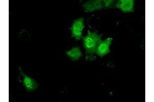 Anti-KHK mouse monoclonal antibody (ABIN2453197) immunofluorescent staining of COS7 cells transiently transfected by pCMV6-ENTRY KHK (RC202424). (Ketohexokinase anticorps)