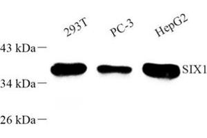 Western blot analysis of SIX1 (ABIN7075617) at dilution of 1: 500 (SIX Homeobox 1 anticorps)