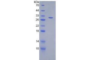 SDS-PAGE analysis of Mouse DGKa Protein. (DGKA Protéine)