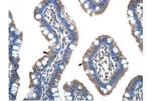 FUS antibody was used for immunohistochemistry at a concentration of 4-8 ug/ml to stain Epithelial cells of intestinal villus (arrows) in Human Intestine. (FUS anticorps  (N-Term))