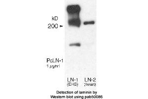 Image no. 1 for anti-Laminin (LN) antibody (ABIN363395) (Laminin anticorps)