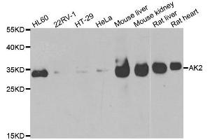 Western blot analysis of extracts of various cell lines, using AK2 antibody. (Adenylate Kinase 2 anticorps)