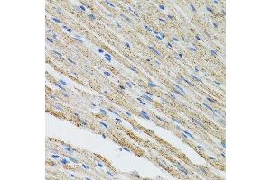 Immunohistochemistry of paraffin-embedded mouse heart using MYOT antibody.