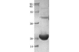 Validation with Western Blot (REG1A Protéine)