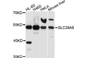 Western blot analysis of extracts of various cell lines, using SLC39A8 antibody (ABIN5998862) at 1/1000 dilution. (SLC39A8 anticorps)