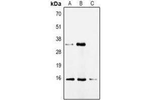 Western blot analysis of CDA expression in HepG2 (A), Hela (B), mouse kidney (C) whole cell lysates. (CDA anticorps)