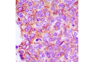 anti-Catenin alpha 1/2 (C-Term) antibody