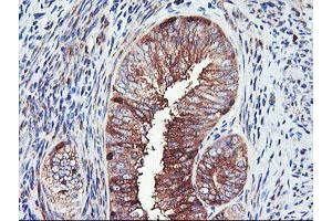 Image no. 10 for anti-phosphofructokinase, Platelet (PFKP) antibody (ABIN1500161)