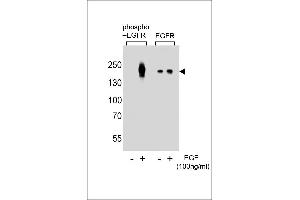 Western blot analysis of lysate from A431 cells(from left to right),untreated or treated with EGF at 100 ng/mL,using Phospho-EGFR-p Antibody (ABIN389891 and ABIN2839735) or EGFR-p Antibody. (EGFR anticorps  (pTyr1016))