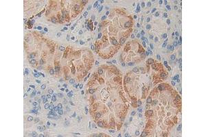 Used in DAB staining on fromalin fixed paraffin- embedded kidney tissue (MCCC2 anticorps  (AA 337-563))