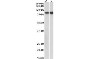 ABIN2561772 (0. (E-cadherin anticorps  (AA 662-675))