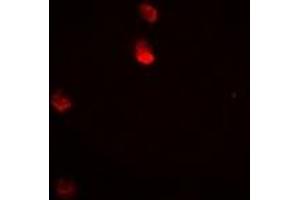 Immunofluorescent analysis of JNK1 staining in Hela cells. (JNK anticorps)