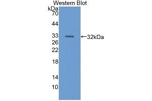Detection of Recombinant Nidogen, Human using Polyclonal Antibody to Nidogen (NID) (Nidogen anticorps  (AA 971-1219))
