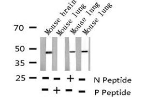 Western blot analysis of Phospho-E2F1 (Thr433) expression in various lysates