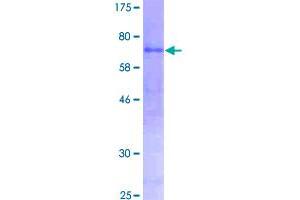 Image no. 1 for Amylase, alpha 2A (Pancreatic) (AMY2A) (AA 1-511) protein (GST tag) (ABIN1345017)