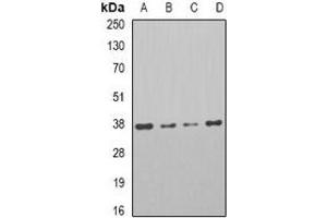 Western blot analysis of PAR6A expression in HT29 (A), Jrukat (B), Raji (C), mouse testis (D) whole cell lysates. (PARD6A anticorps)