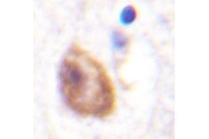 Immunohistochemistry analyzes of DDX3 antibody in paraffin-embedded human brain tissue. (DDX3X anticorps)