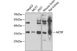 Western blot analysis of extracts of various cell lines, using AKTIP antibody (ABIN6131091, ABIN6136746, ABIN6136748 and ABIN6221837) at 1:1000 dilution. (AKTIP anticorps  (AA 1-292))