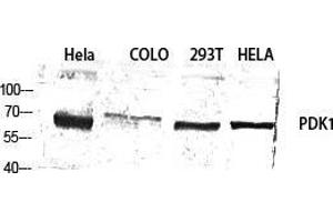Western Blot (WB) analysis of specific cells using PDK1 Polyclonal Antibody. (PDPK1 anticorps  (Thr222))