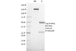 SDS-PAGE Analysis Purified SOX4 Mouse Monoclonal Antibody (SOX4/2540). (SOX4 anticorps)