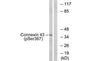 Western blot analysis of extracts from K562 cells treated with PMA 200ng/ml 10', using Connexin 43 (Phospho-Ser367) Antibody. (Connexin 43/GJA1 anticorps  (pSer367))