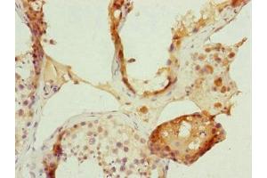Immunohistochemistry of paraffin-embedded human testis tissue using ABIN7152485 at dilution of 1:100 (FBXL5 anticorps  (AA 1-310))