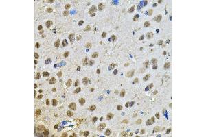 Immunohistochemistry of paraffin-embedded rat brain using PPID Antibody.