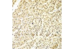 Immunohistochemistry (IHC) image for anti-Lamin A/C (LMNA) (AA 403-572) antibody (ABIN3020785)