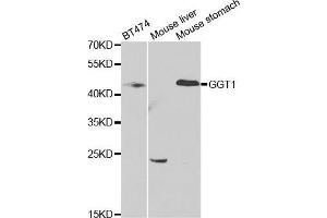 Western blot analysis of extracts of various cell lines, using GGT1 antibody.