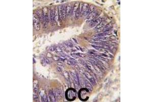 Immunohistochemistry (IHC) image for anti-Suppression of Tumorigenicity 13 (ST13) antibody (ABIN2971014)