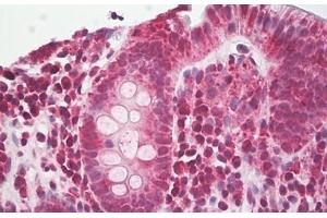 Image no. 2 for anti-NLR Family, Pyrin Domain Containing 3 (NLRP3) (AA 158-207) antibody (ABIN6749780) (NLRP3 anticorps  (AA 158-207))