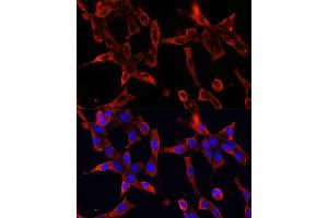 Immunofluorescence analysis of NIH-3T3 cells using FBN1 Polyclonal Antibody (ABIN7267176) at dilution of 1:100 (40x lens).