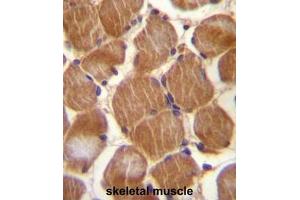 ASAM Antibody (Center) immunohistochemistry analysis in formalin fixed and paraffin embedded human skeletal muscle followed by peroxidase conjugation of the secondary antibody and DAB staining.