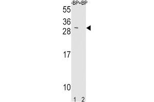 Western Blotting (WB) image for anti-TIMP Metallopeptidase Inhibitor 3 (TIMP3) antibody (ABIN3004040)